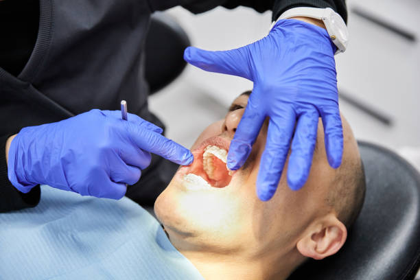 Best Emergency Dental Care for Broken or Chipped Teeth in Ulysses, KS