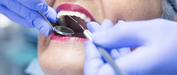 Best Emergency Root Canal Treatment in Ulysses, KS